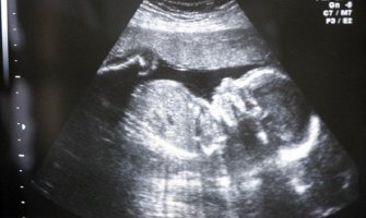 Španci ipak nisu za zabranu abortusa