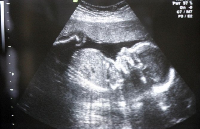 Španci ipak nisu za zabranu abortusa