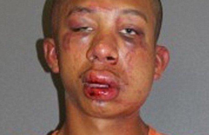 Zatekao manijaka kako mu siluje sina i unakazio ga