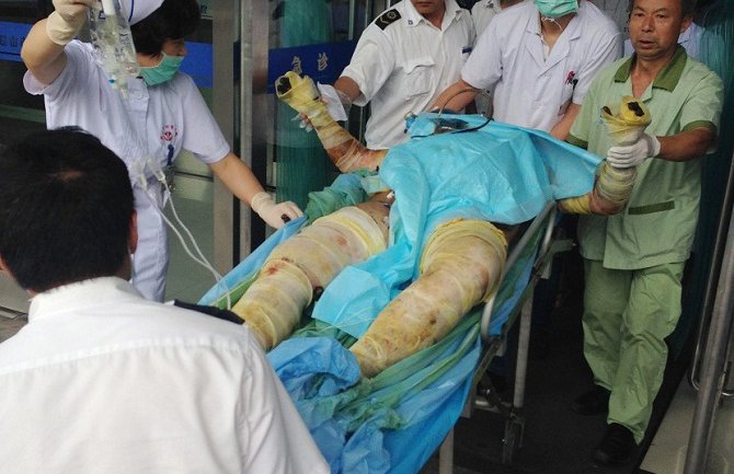 U Kineskoj fabrici izbila eksplozija, ljudi živi gorjeli! (FOTO)