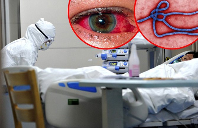 Nepoznati muškarac sa simptomima zbrinut u njujorškoj bolnici