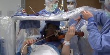Svira violinu tokom operacije na mozgu (VIDEO)