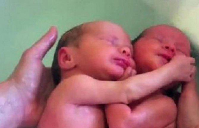 Zagrljeni blizanci misle da su u maminom stomaku