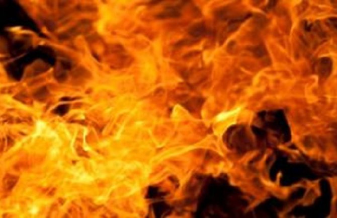 Njemačka: Šestogodišnji dječak se igrao s vatrom pa se zapalio