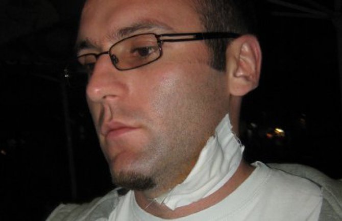 Gazda ujeo radnika za vrat jer mu je tražio platu 