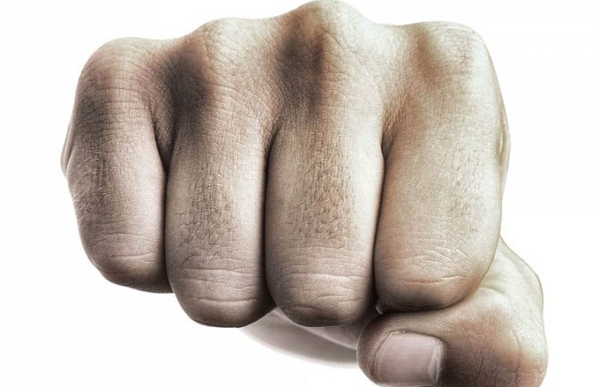 Pretučeni Beograđanin u Sutomoru štitio Ukrajinke?