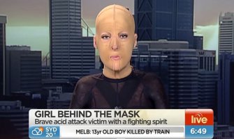 Australijanku zapalila ljubomorna žena(VIDEO)