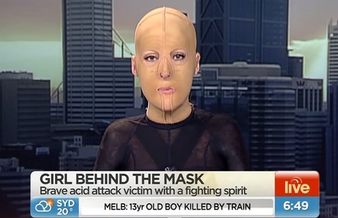 Australijanku zapalila ljubomorna žena(VIDEO)