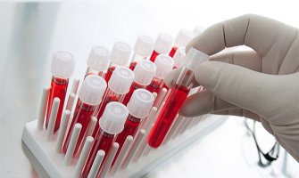 Revolucionarno otkriće: Test krvi koji otkriva rak prije pojave simptoma 