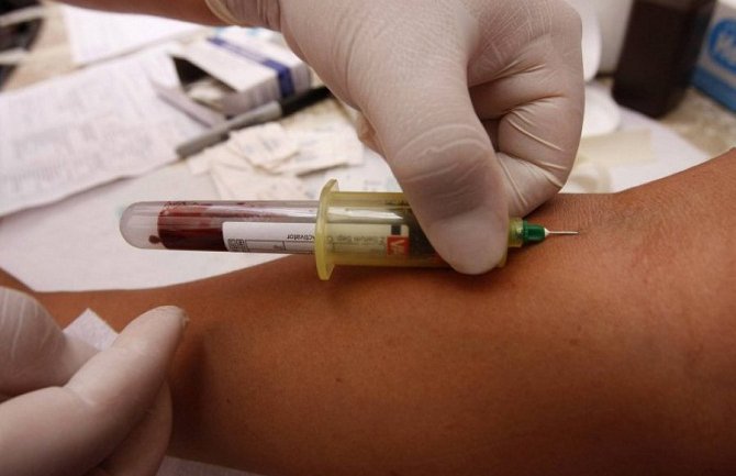 HIV otkriven kod još 17 osoba u Crnoj Gori