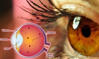 Evo šta su one čudne stvari koje vam plutaju ispred očiju