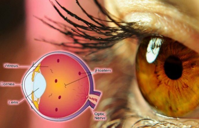 Evo šta su one čudne stvari koje vam plutaju ispred očiju