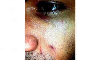 Napadnuti R.B.: Kriv sistem ne dijete