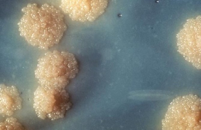 Otkriven antibiotik koji savladava otpor superbakterija