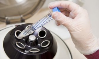 Za vještačku oplodnju 513 zahtjeva 