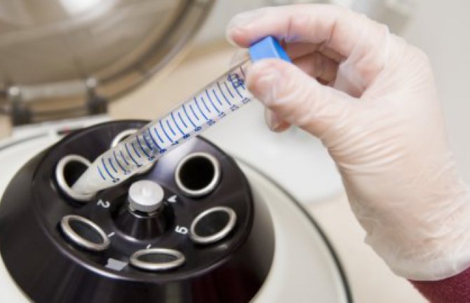 Za vještačku oplodnju 513 zahtjeva 