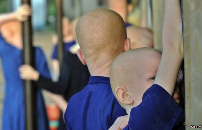 Tanzanija: U šumi pronađeno izmasakrirano tijelo albino bebe