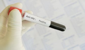 Francuski naučnici otkrili molekul koji može da blokira HIV virus