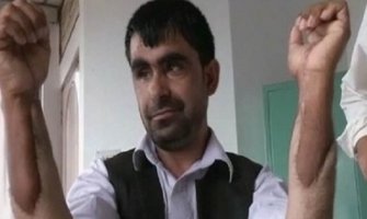 Avganistanskom kapetanu presađene ruke Indijca ( Video)