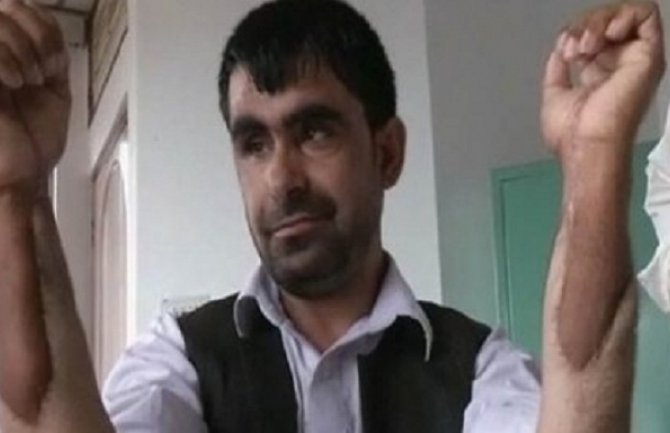 Avganistanskom kapetanu presađene ruke Indijca ( Video)