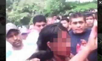 Djevojčicu živu spalili nasred ulice! (FOTO)