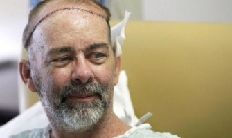 Uspješna  prva transplantacija lobanje