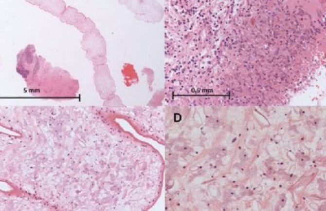 Računar samostalno riješio 120 godina staru biološku zagonetku