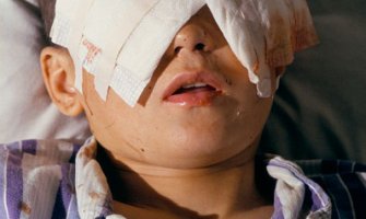 Komšinica iskopala dječaku oči pa se ubila