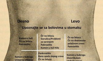 Boli vas stomak, a ne znate zašto? Ova slika će vam riješiti sve nedoumice