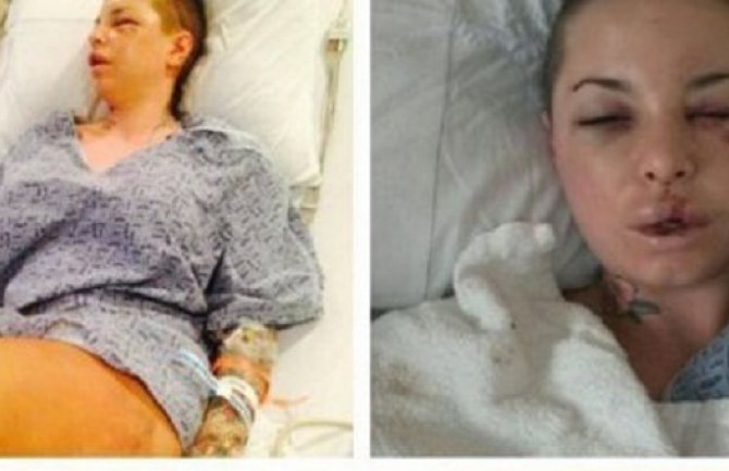 Bivši MMA borac polomio djevojci 18 kostiju, a njegovi argumenti su nevjerovatni