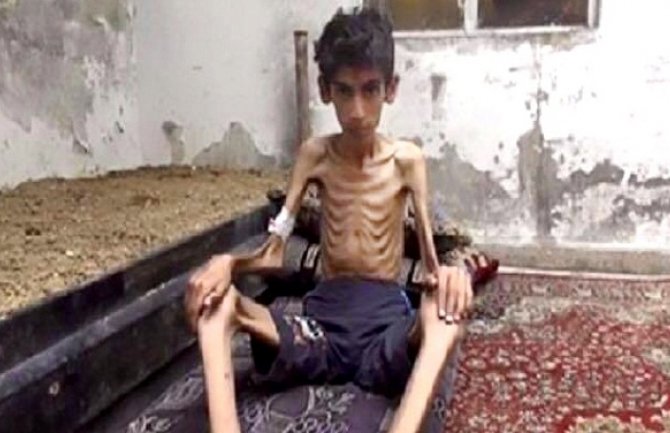 U Madaji od decembra 23 osobe umrle od gladi