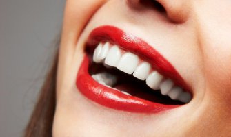 Sačuvajte blistav osmjeh: Ove namirnice uništavaju zube