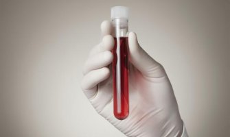 Testovi krvi će pokazivati da li su nam potrebni antibiotici