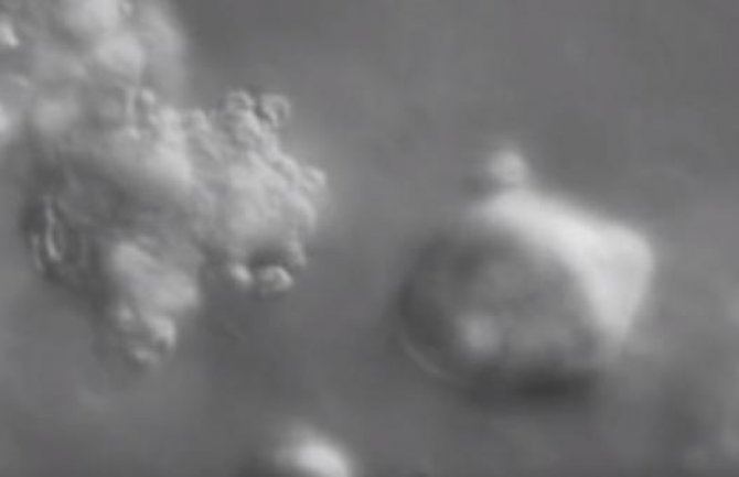 Naučnici snimili proces nastanka kancera (VIDEO)