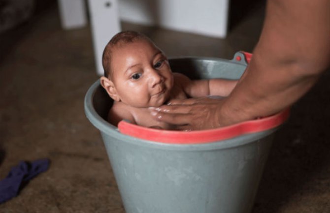 Tromjesečna beba ima simptome Zika virusa