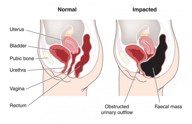 Riješite se naduvanog stomaka zauvijek i izravnajte ga uz ova 3 savjeta