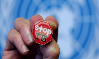 Broj oboljelih od tuberkuloze u padu: Prošle godine otkriveno 80 oboljelih