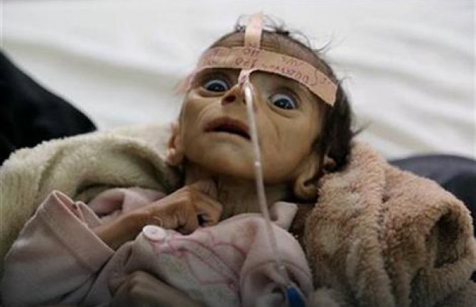 Evo kakva se priča krije iza fotografije ovog dječaka