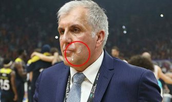 Galatasaraj: Obradović pogođen je jogurtom, nije pljunut(VIDEO)