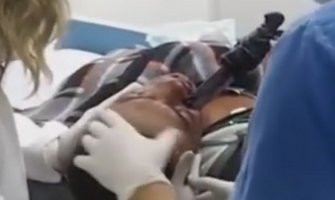 Pijani čovjek sa zarivenim nožem u lice došao na kliniku, ljekari ga spasili (Video)