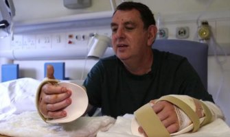 Velika Britanija: Prva uspješna transplantacija obje šake (VIDEO)
