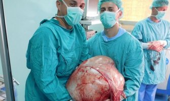 Banja Luka: Doktori odstranili tumor težak 31 kilogram
