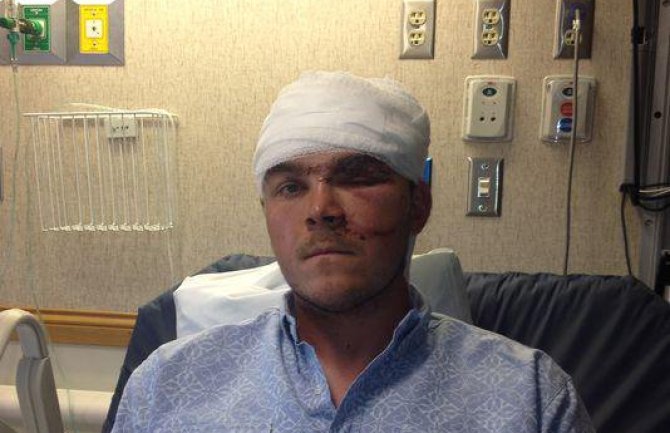 Preživio je napad medvjeda: Želim svi da znaju da medved nije kriv