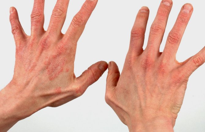 Povučeno više serija 