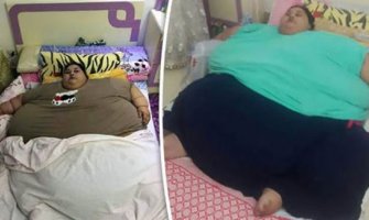 Žena od 500kg ide na operaciju za smanjivanje težine