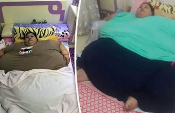 Žena od 500kg ide na operaciju za smanjivanje težine