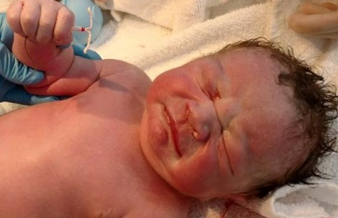 Slika novorođene bebe oduševila planetu: Došao na svijet držeći u ruci kontraceptivnu spiralu