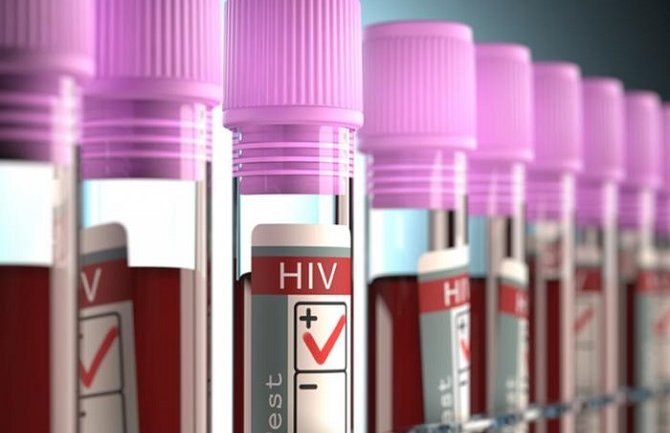 Srbija izdvojila 10 miliona eura za liječenje osoba sa HIV-om