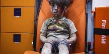 Ovako izgleda Oman, ranjeni dječak iz Sirije čija je fotografija potresla svijet (FOTO/VIDEO)