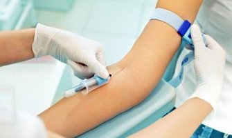 Građani Bijelog Polja od 3.jula laboratorijske nalaze davaće u Domu zdravlja